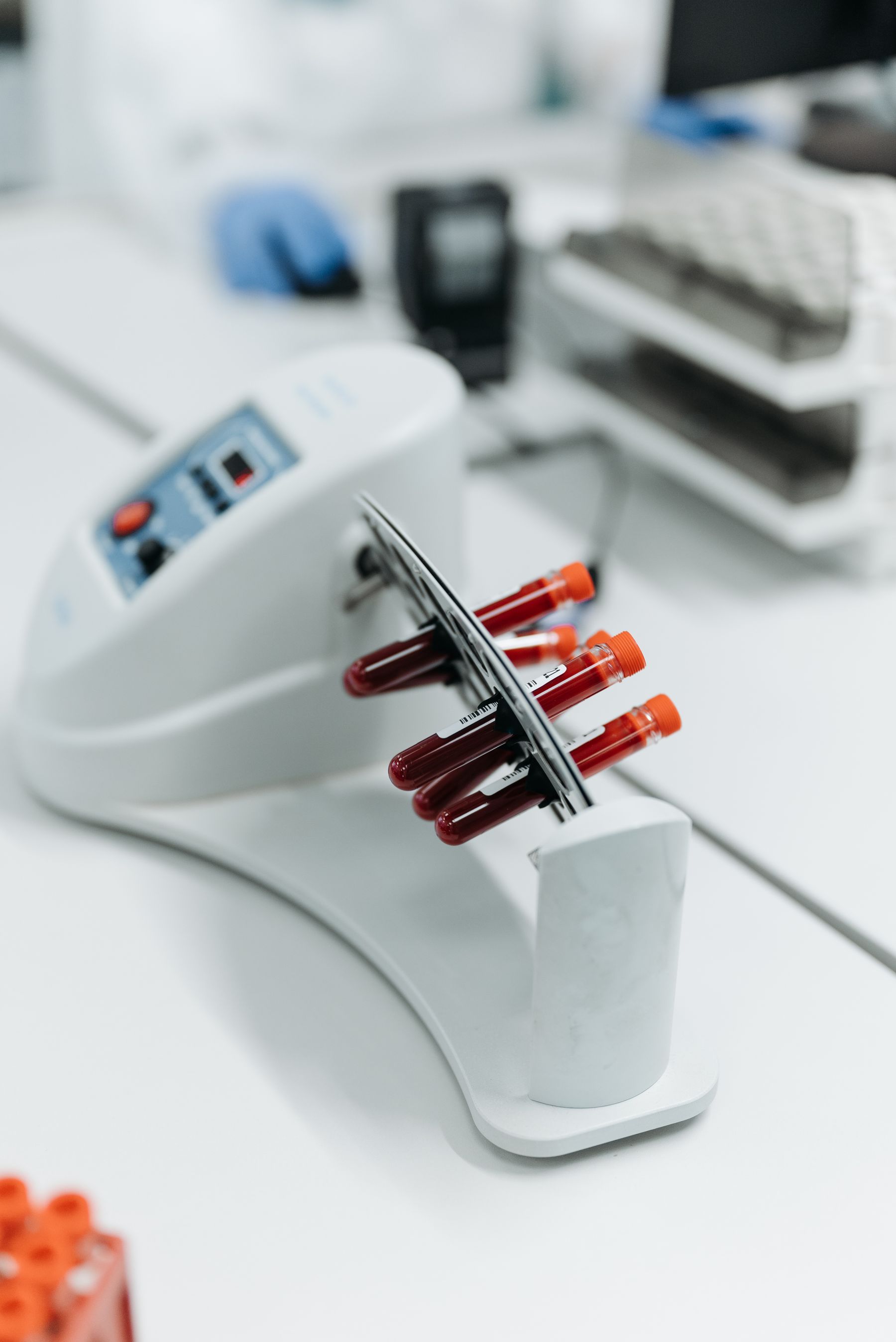 Laboratory equipment used for blood testing